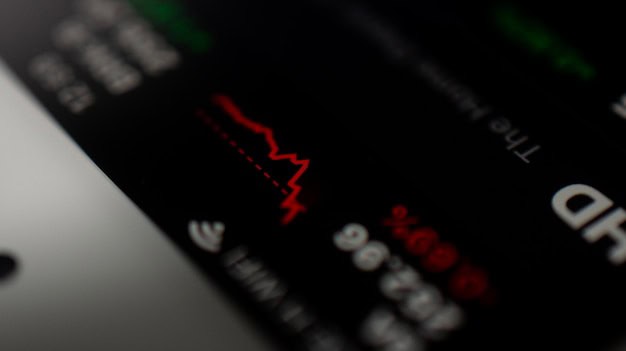 Cvs Health Stock Surges